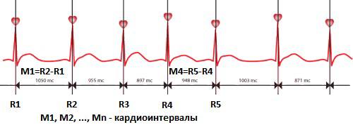 Кардиоинтервалография